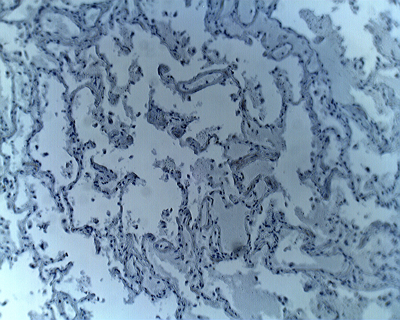 Immunohistochemical staining of human lung tissue using Aprataxin antibody at 5 µg/ml